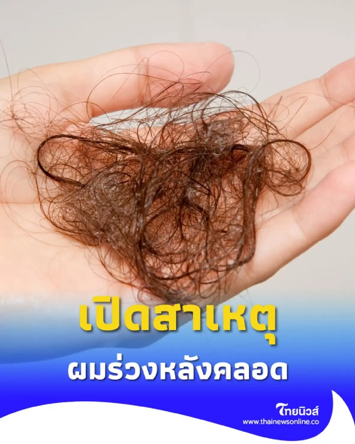 เปิดสาเหตุภาวะ ผมร่วงหลังคลอด พร้อม 4 เคล็ดลับกู้ผมหนาคืนมา