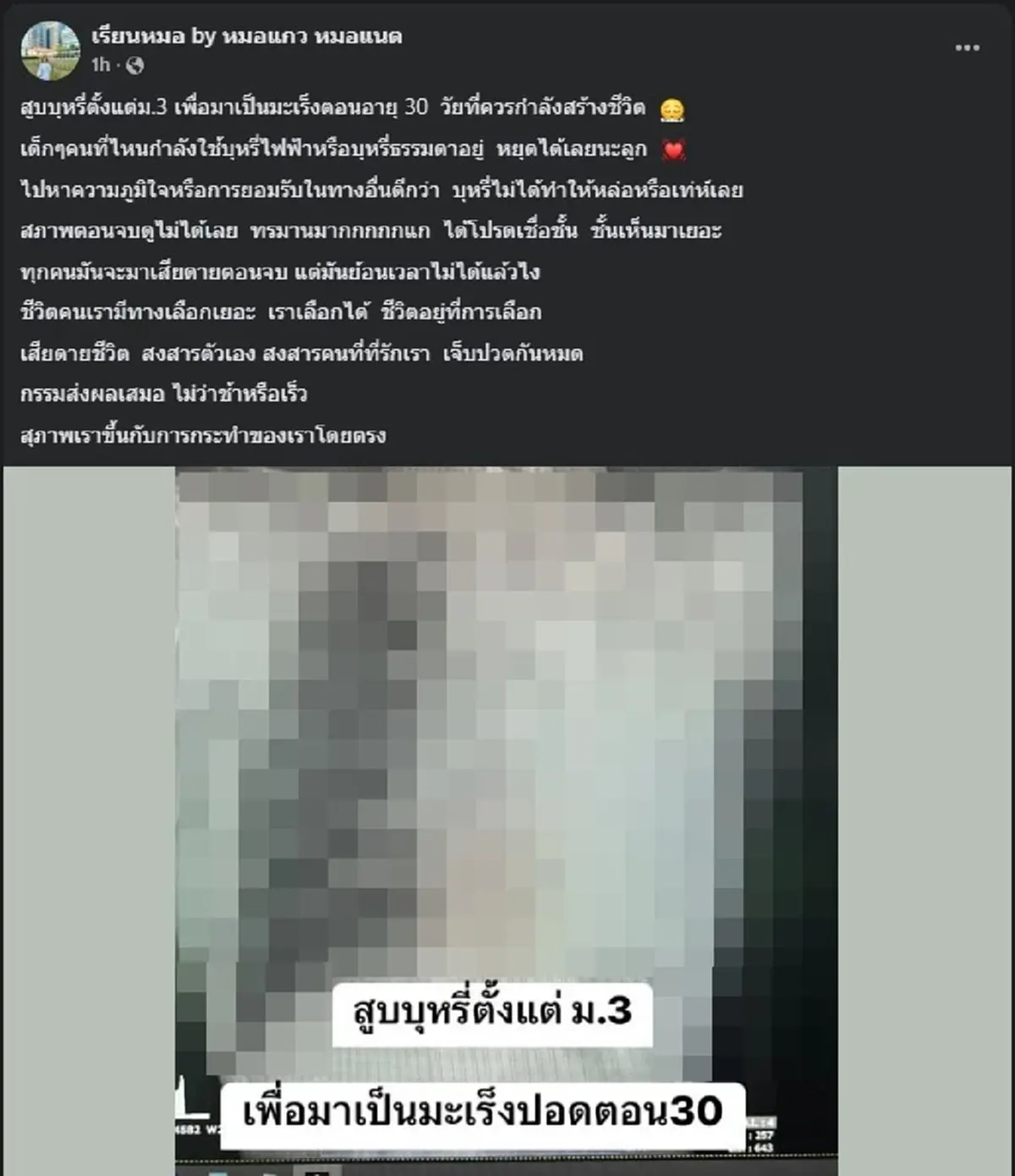 เปิดเคสอุทาหรณ์ สูบบุหรี่ตั้งแต่ม.3 สุดท้าย เจอเต็ม ๆ ตอนอายุ 30 