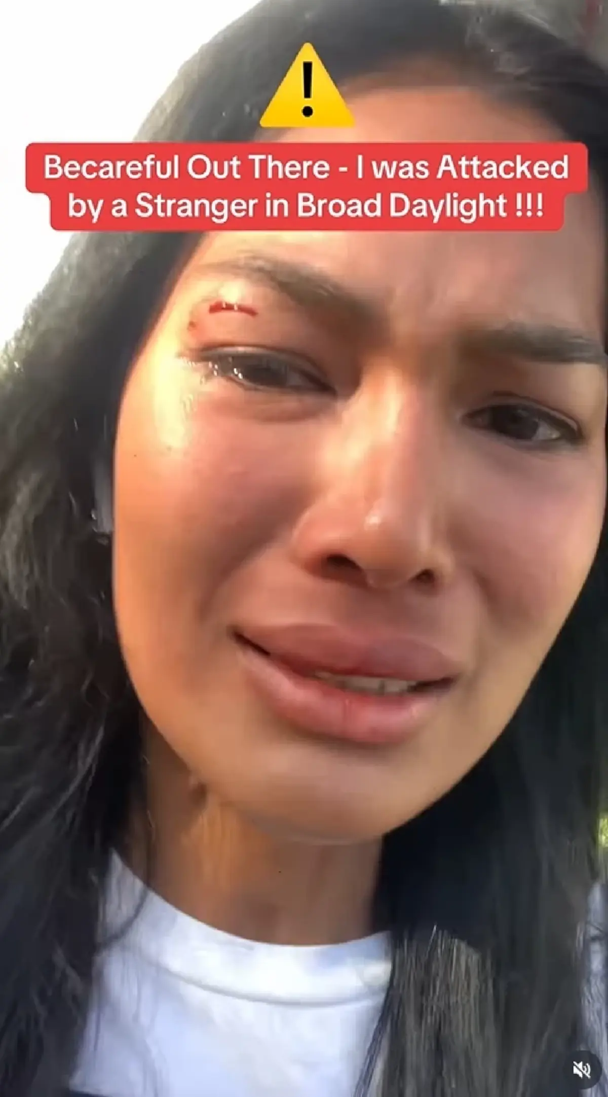 "นางแบบไทย" เผยนาทีระทึก ถูกคนแปลกหน้าทำร้ายกลางลอสแอนเจลิส