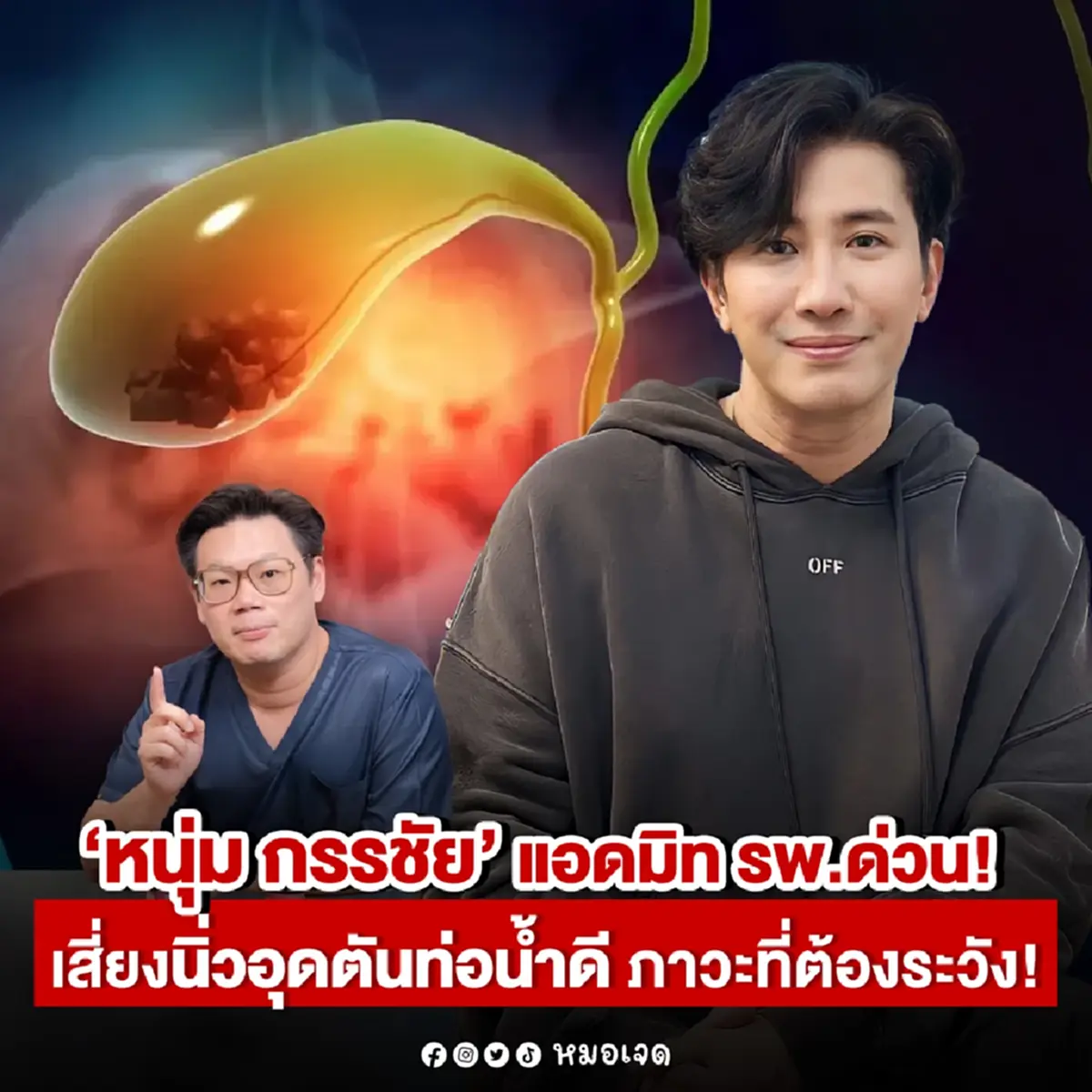 หมอเจด พูดตรง ๆ เคส "หนุ่ม กรรชัย" ปวดท้อง-ค่าไตสูง อย่าชะล่าใจ