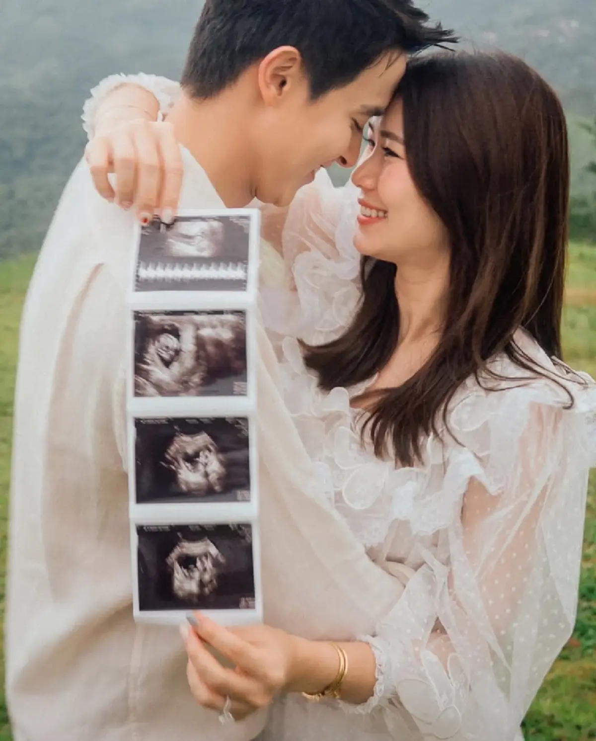 เจมส์ จิรายุ เผยภาพลูกชายในครรภ์ ดั้งโด่งหล่อแรงแซงคุณพ่อ