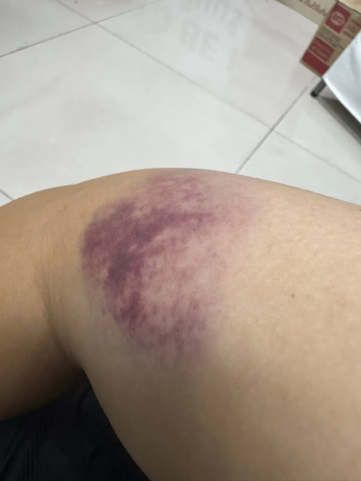 สาวสุดทน ถูกคนสติไม่ดีทำร้าย ตำรวจไม่ยอมจับ ต้องอยู่แบบหวาดระแวง