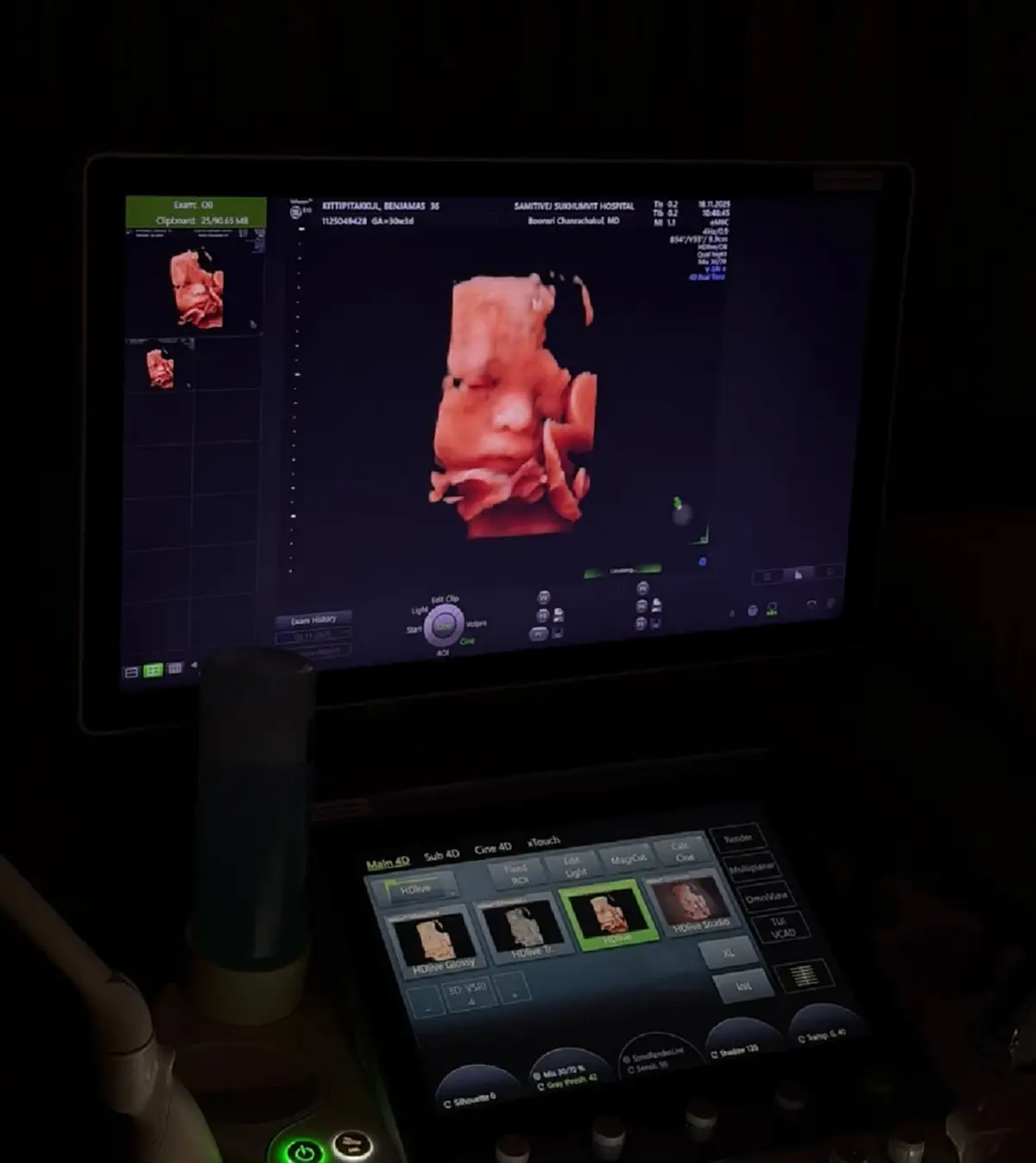 เจมส์ จิรายุ เผยภาพลูกชายในครรภ์ ดั้งโด่งหล่อแรงแซงคุณพ่อ