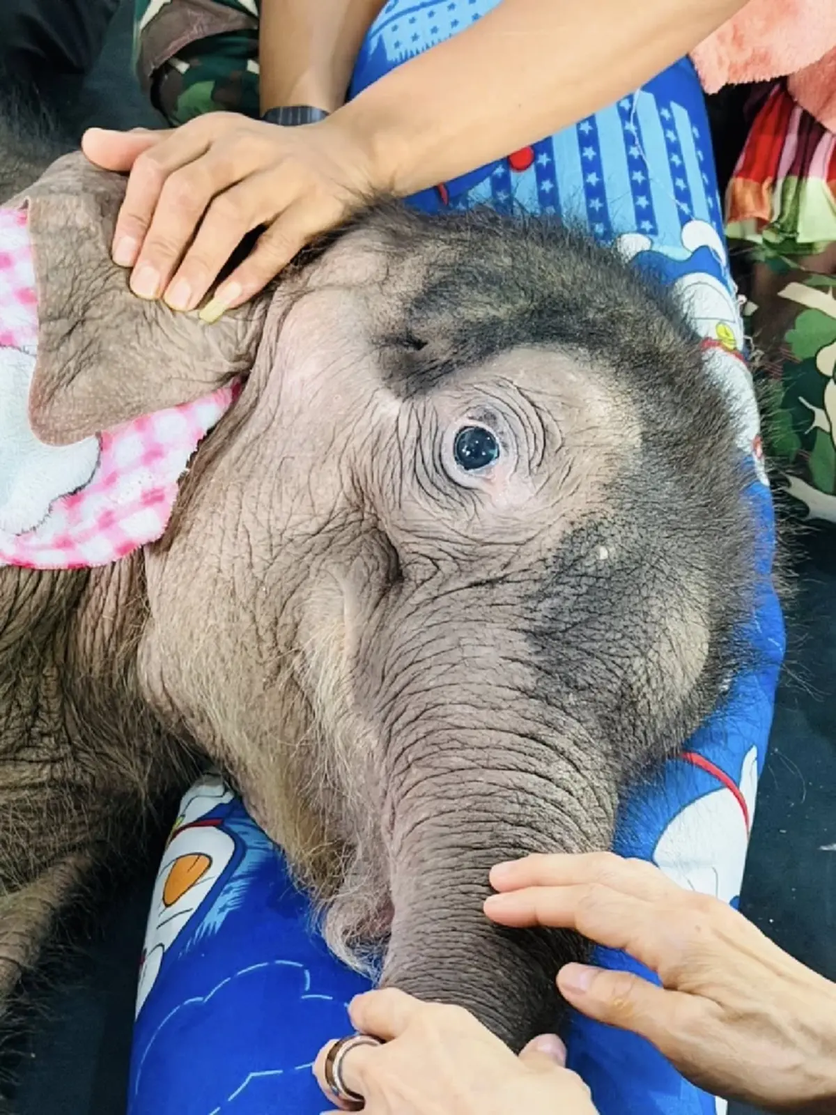 มีข่าวดี อาการล่าสุด น้องข้าวต้ม หลังจากให้สเต็มเซลล์