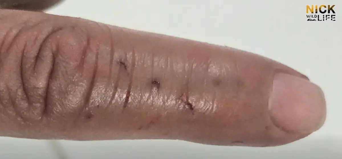 "บังยา" โพสต์ตรงๆ ถึง "นิค อสรพิษวิทยา" หลังรู้ข่าวถูกงูจงอางกัด