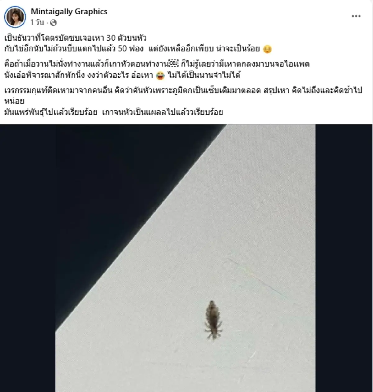 ไวรัลสนั่น สาวผงะ เจอเหา 30 ตัวบนหัว ต้นตอใกล้ตัวกว่าที่คิด