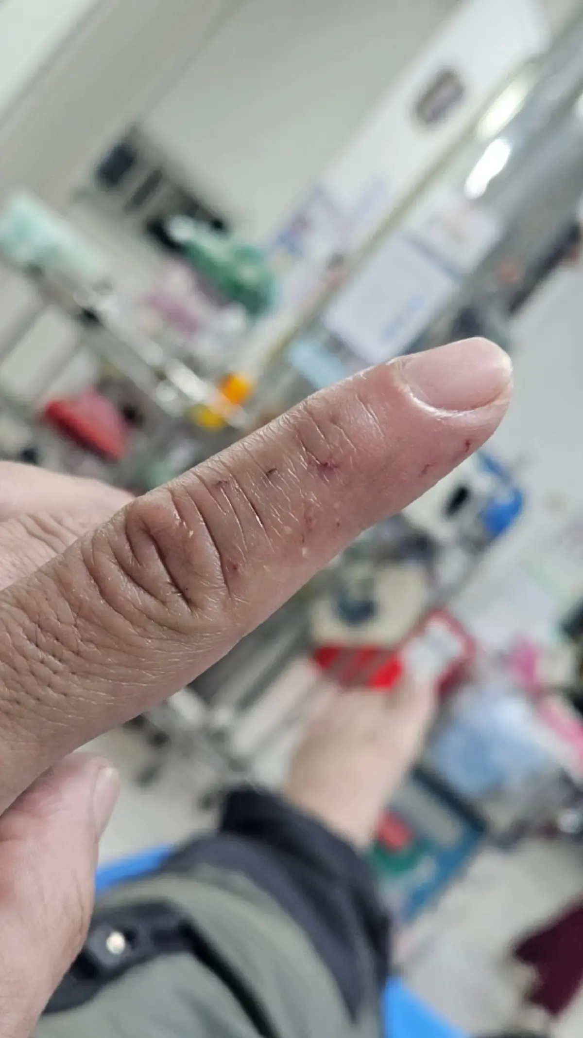 เปิดนาทีชีวิต"นิค อสรพิษวิทยา"เจอพิษจงอาง ไม่คิดว่ามันจะกัดได้