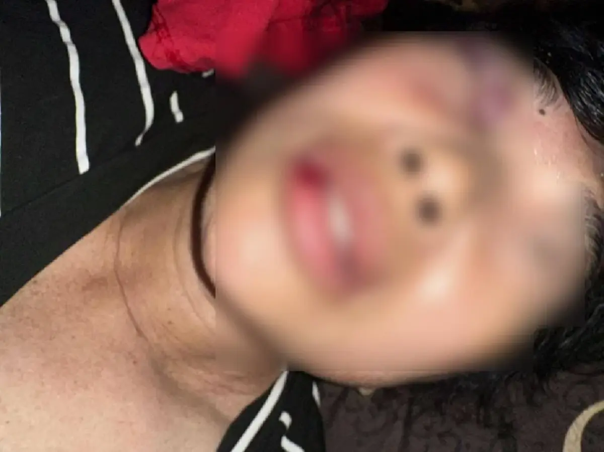 แฉรองผอ.โรงเรียนดัง ขับข้ามเลนชนแม่ ปัดเยียวยา ลั่นไปฟ้องเอา