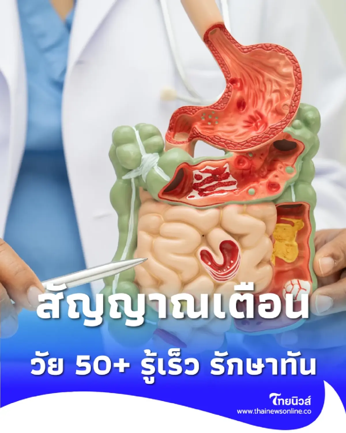 เปิดสัญญาณเตือน ระบบทางเดินอาหารวัย 50+ รู้เร็ว รักษาทัน 