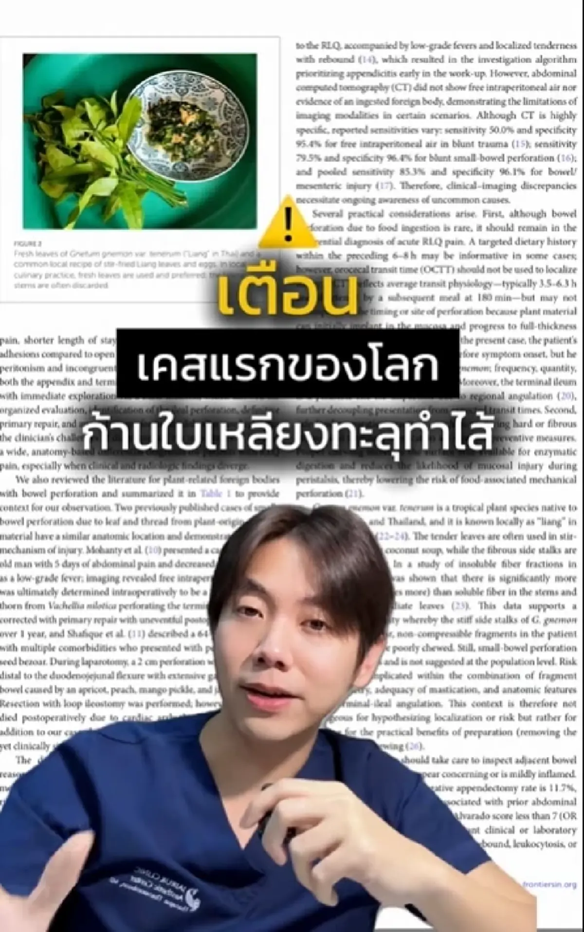 เคสแรกของโลก ก้านใบเหลียงแผลงฤทธิ์ สาเหตุปวดท้องหนัก