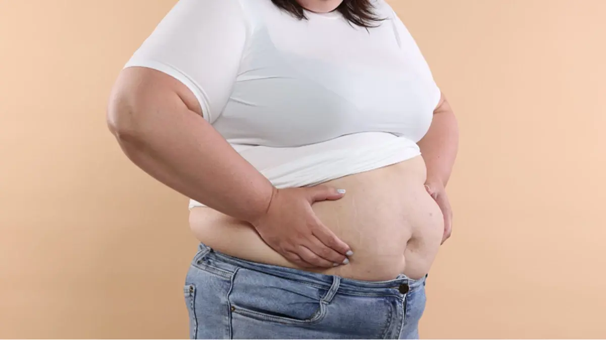 รู้จัก “อ้วนเพราะฮอร์โมน” ตัวการเงียบที่หลายคนมองข้าม