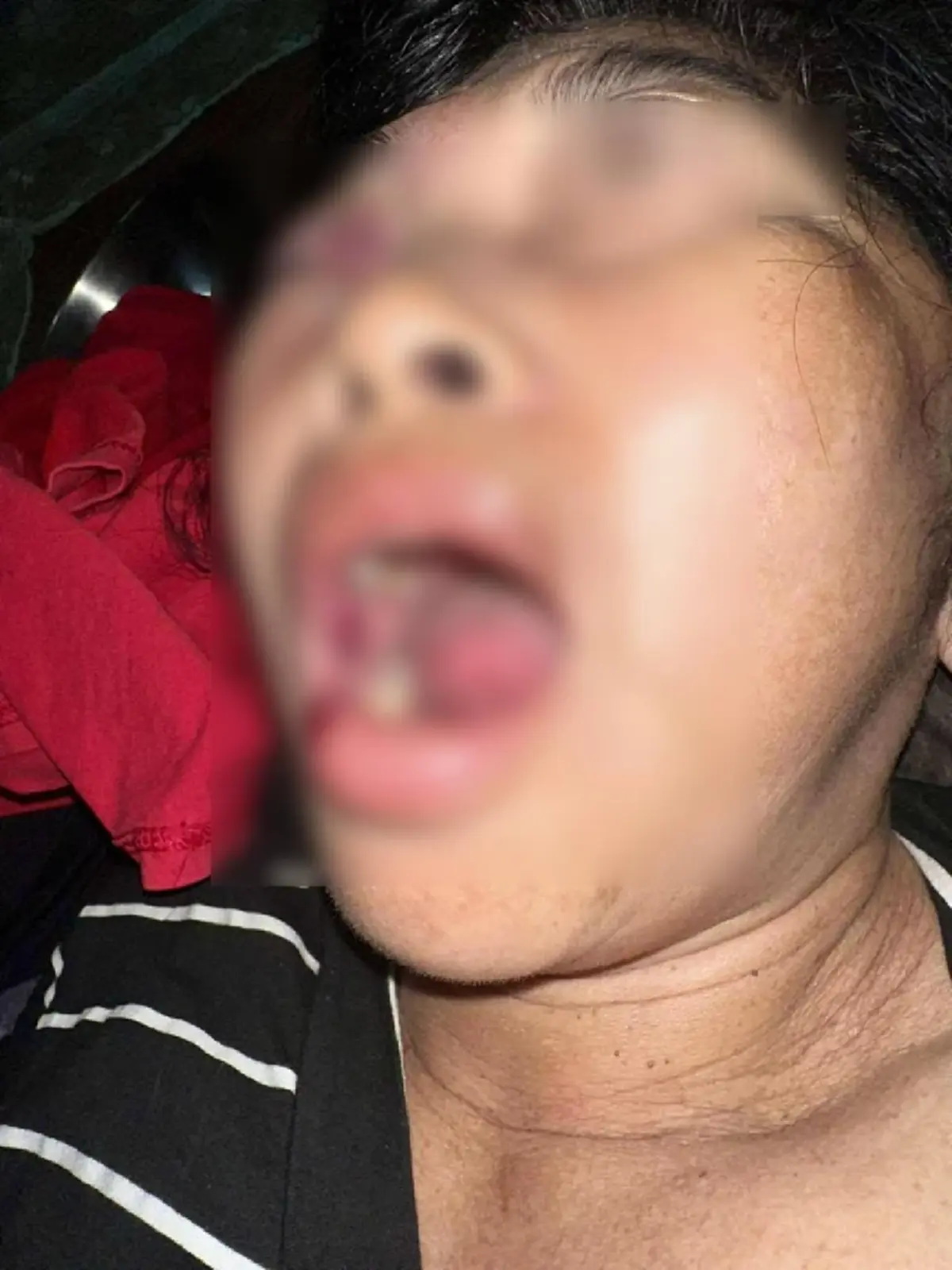 แฉรองผอ.โรงเรียนดัง ขับข้ามเลนชนแม่ ปัดเยียวยา ลั่นไปฟ้องเอา