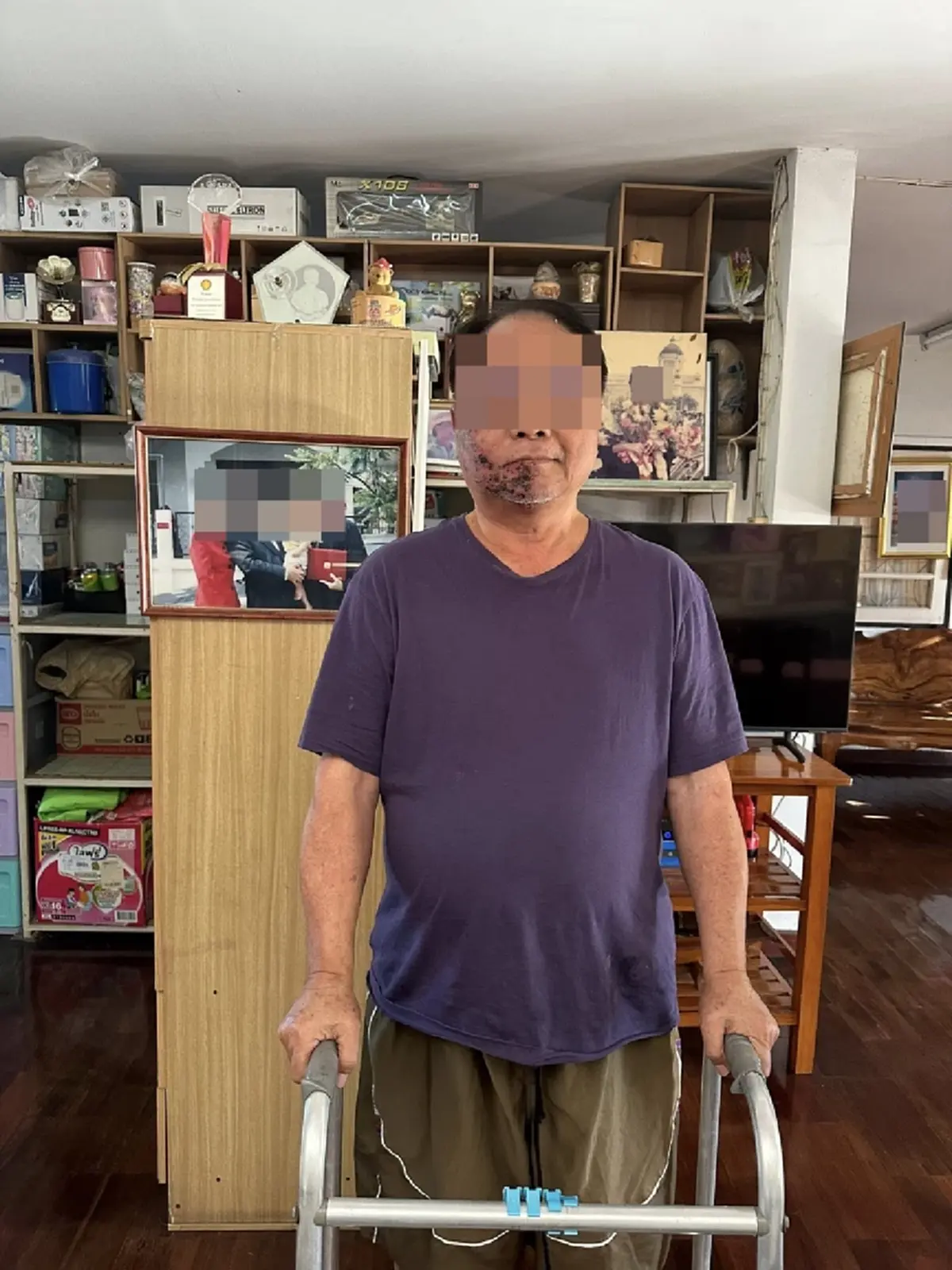 อุทาหรณ์ชั้นดี หมดเงินเฉียดล้าน เหตุเพราะเป็น โรคงูสวัด