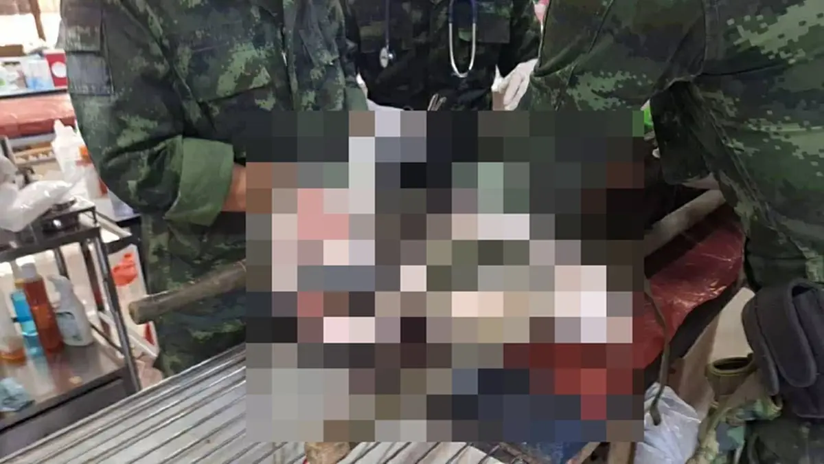 เดือดหนัก ทหารไทยสูญเสียขาอีกราย เขาสัตตะโสม เป็นขาที่ 11