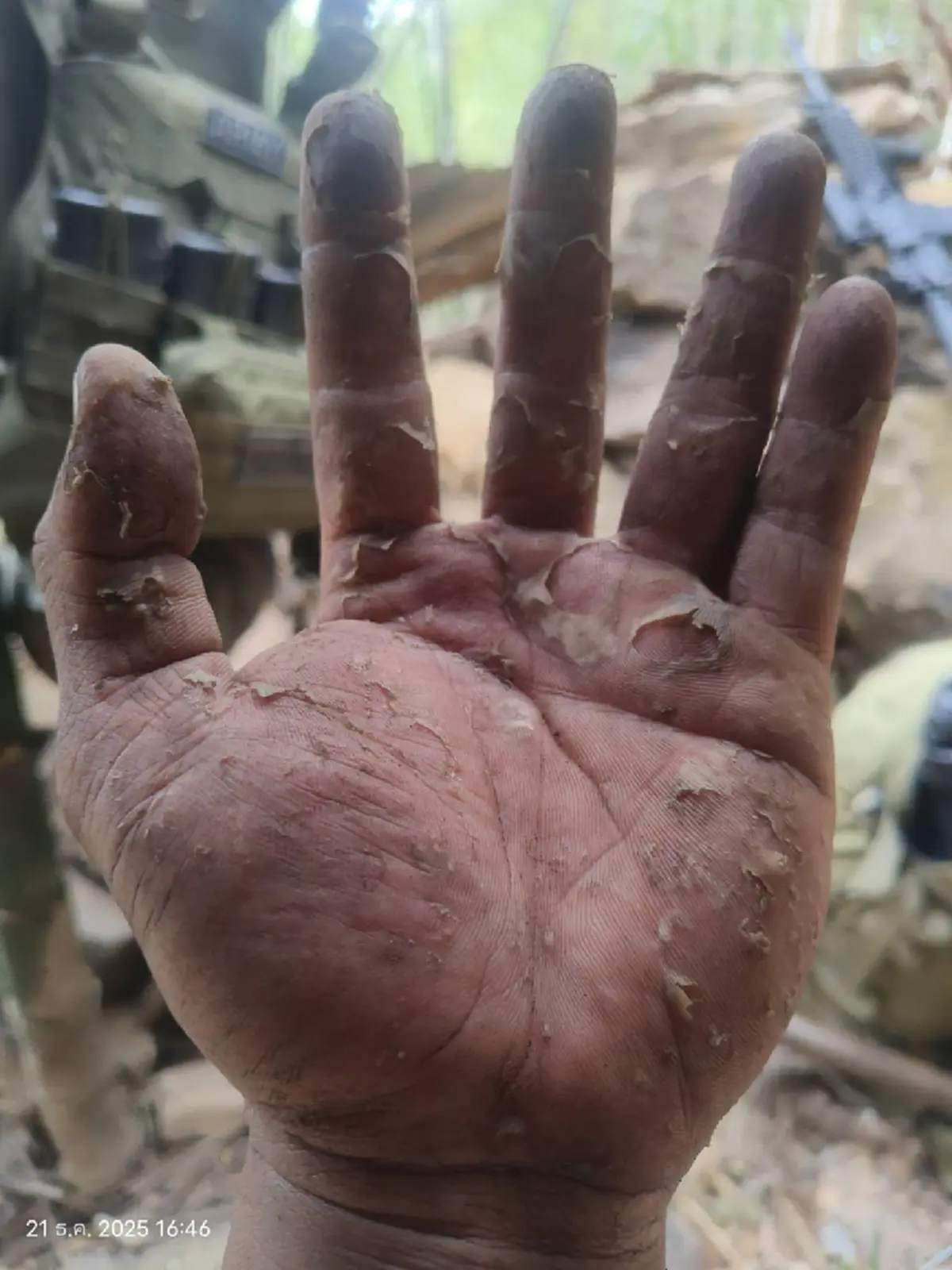 ทหารแนวหน้า เปิดสภาพมือของตนเอง หลังทำหน้าที่รักษาแผ่นดินไทย