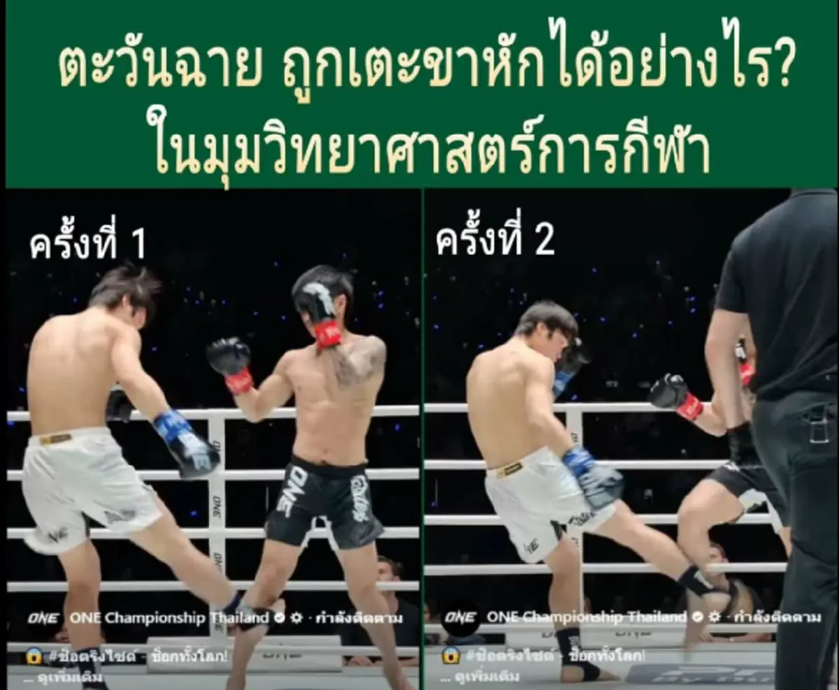 เปิดเคส "ตะวันฉาย" สาเหตุแค่โดนเตะที่ขา แต่ทำไมถึงขั้นหัก