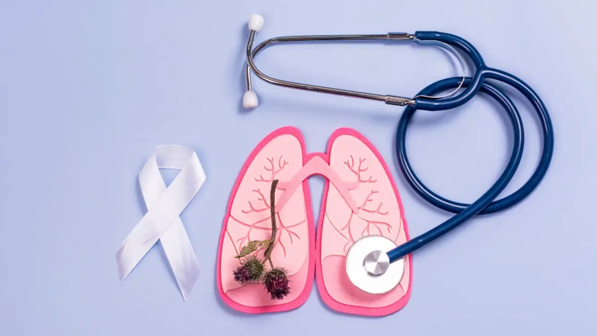 พบหญิงเอเชียไม่สูบบุหรี่ เสี่ยงมะเร็งปอดเกินคาดการณ์