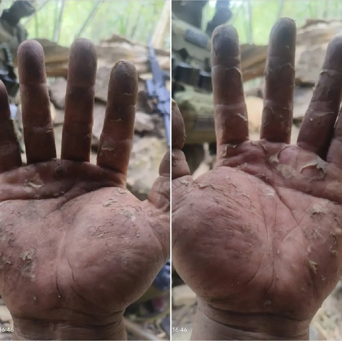 ทหารแนวหน้า เปิดสภาพมือของตนเอง หลังทำหน้าที่รักษาแผ่นดินไทย