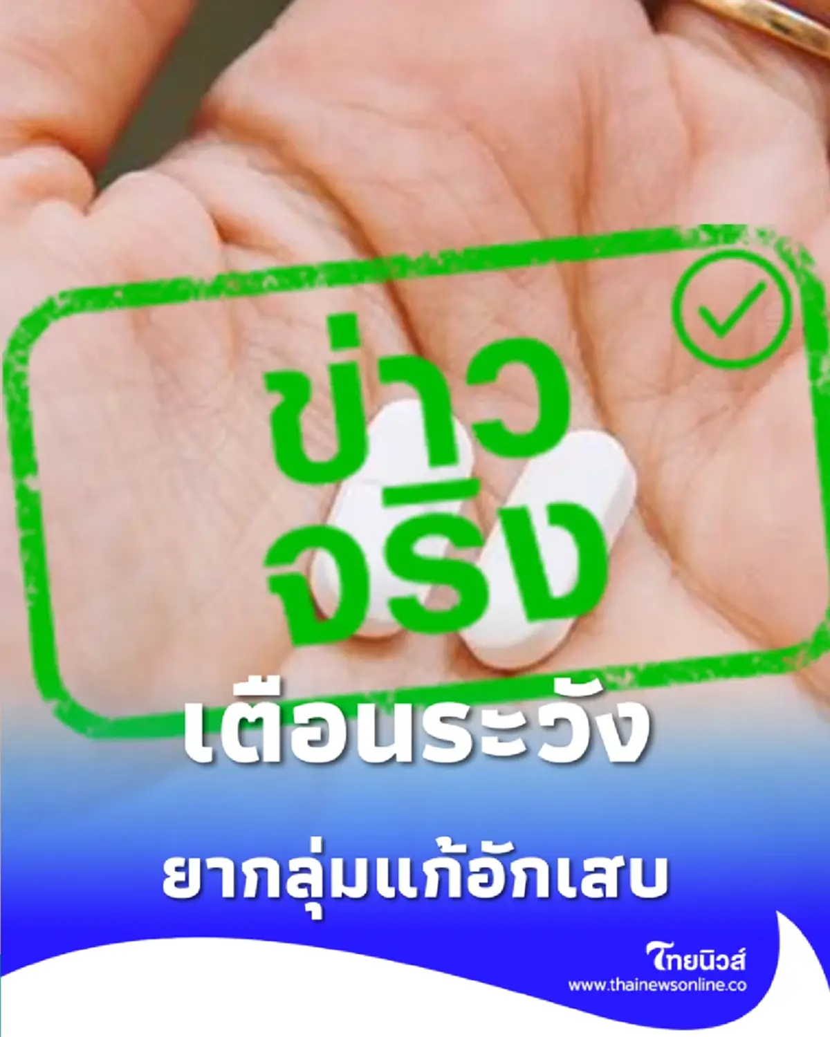 เช็กสัญญาณเตือน ยากลุ่มแก้อักเสบ กินผิดวิธี โรคกระเพาะมาเยือน