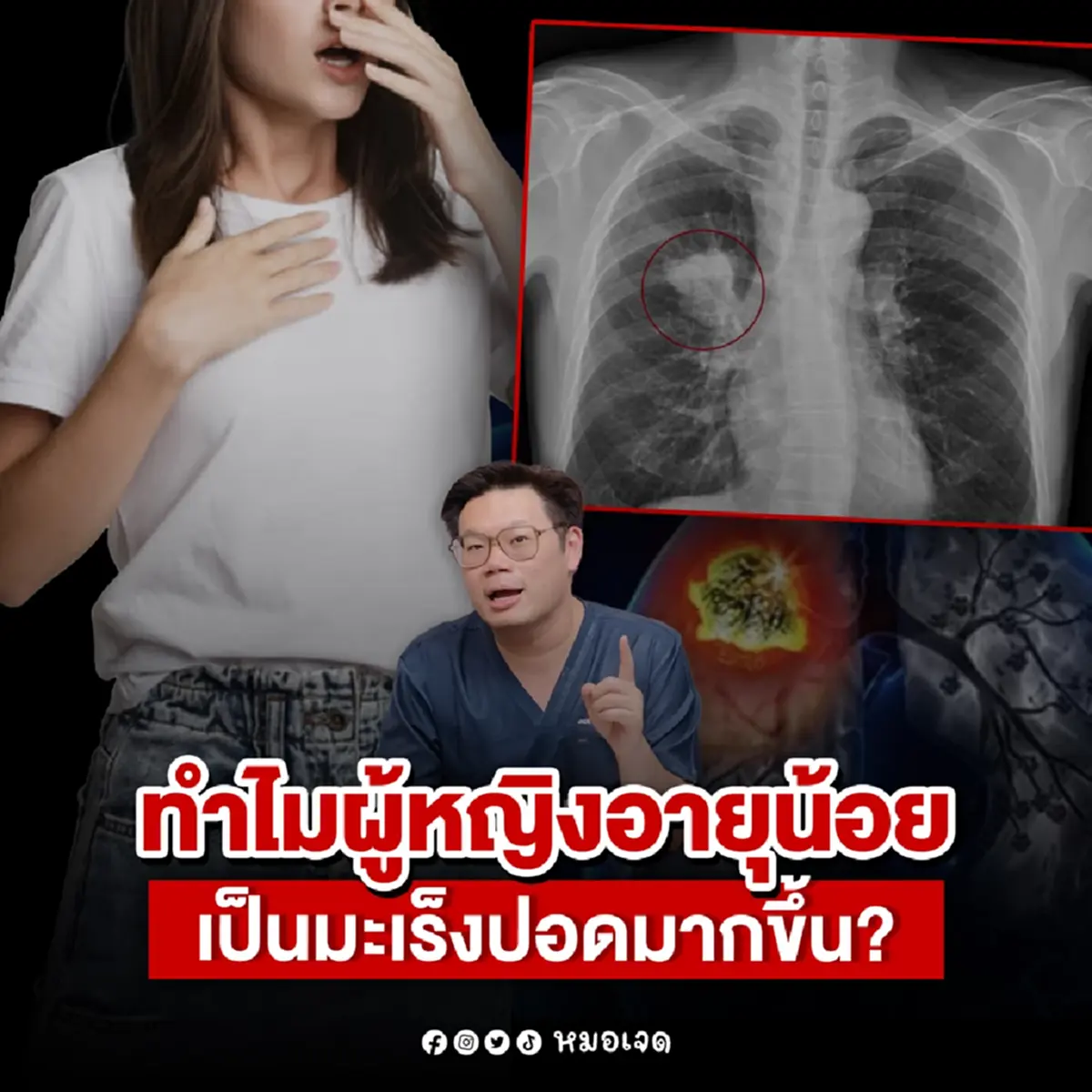 เปิดสาเหตุ 5ข้อ ที่ ผู้หญิงอายุน้อย เป็นมะเร็งปอดมากขึ้น
