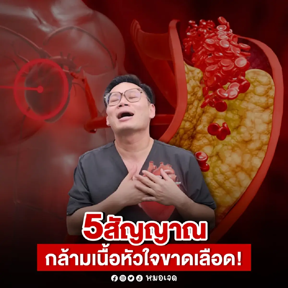 เปิด 5สัญญาณ กล้ามเนื้อหัวใจขาดเลือด เสี่ยงหัวใจวาย อันตรายมาก 