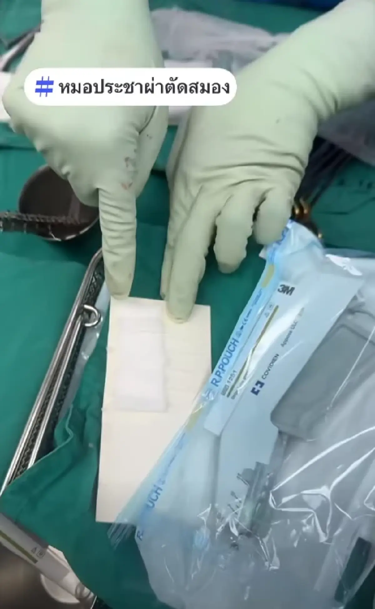 "หมอประชา"เตือนกลุ่มเสี่ยงหน้าหนาว ทำเส้นเลือดในสมองแตก