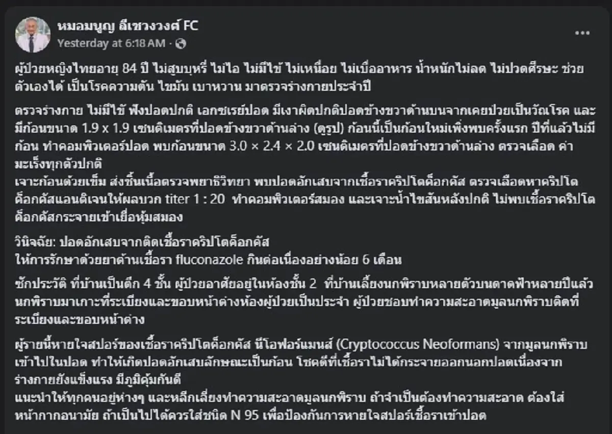 สะพรึง หญิงตรวจพบ ก้อนในปอด สุดท้ายเจอต้นตอ มันมาจากนกพิราบ 