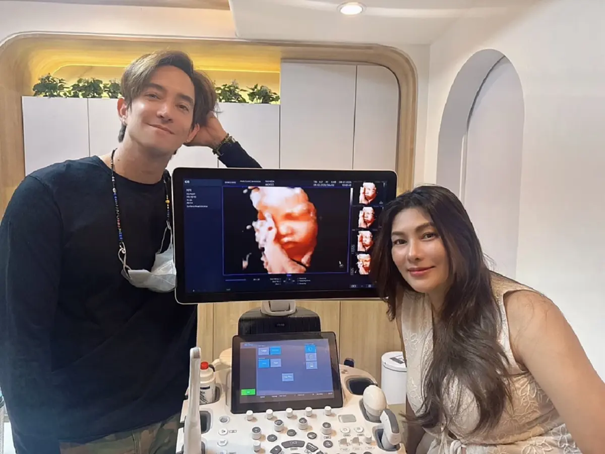 เปิดรายละเอียด งานแถลงข่าว หลุยส์ - นุ่น พรุ่งนี้ โดยสูตินรีแพทย์