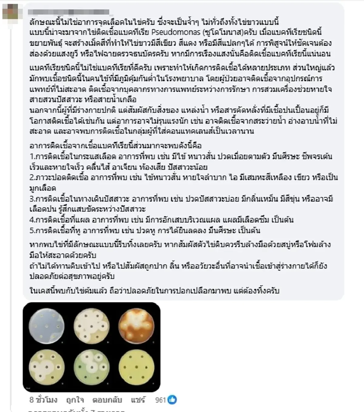 ฮือฮา "ไข่ต้มสีชมพู" สีหวานชวนงง แต่ความจริงอันตรายกว่าที่คิด