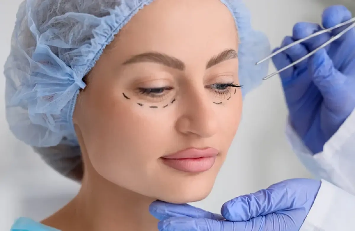 การศัลยกรรมถุงใต้ตา