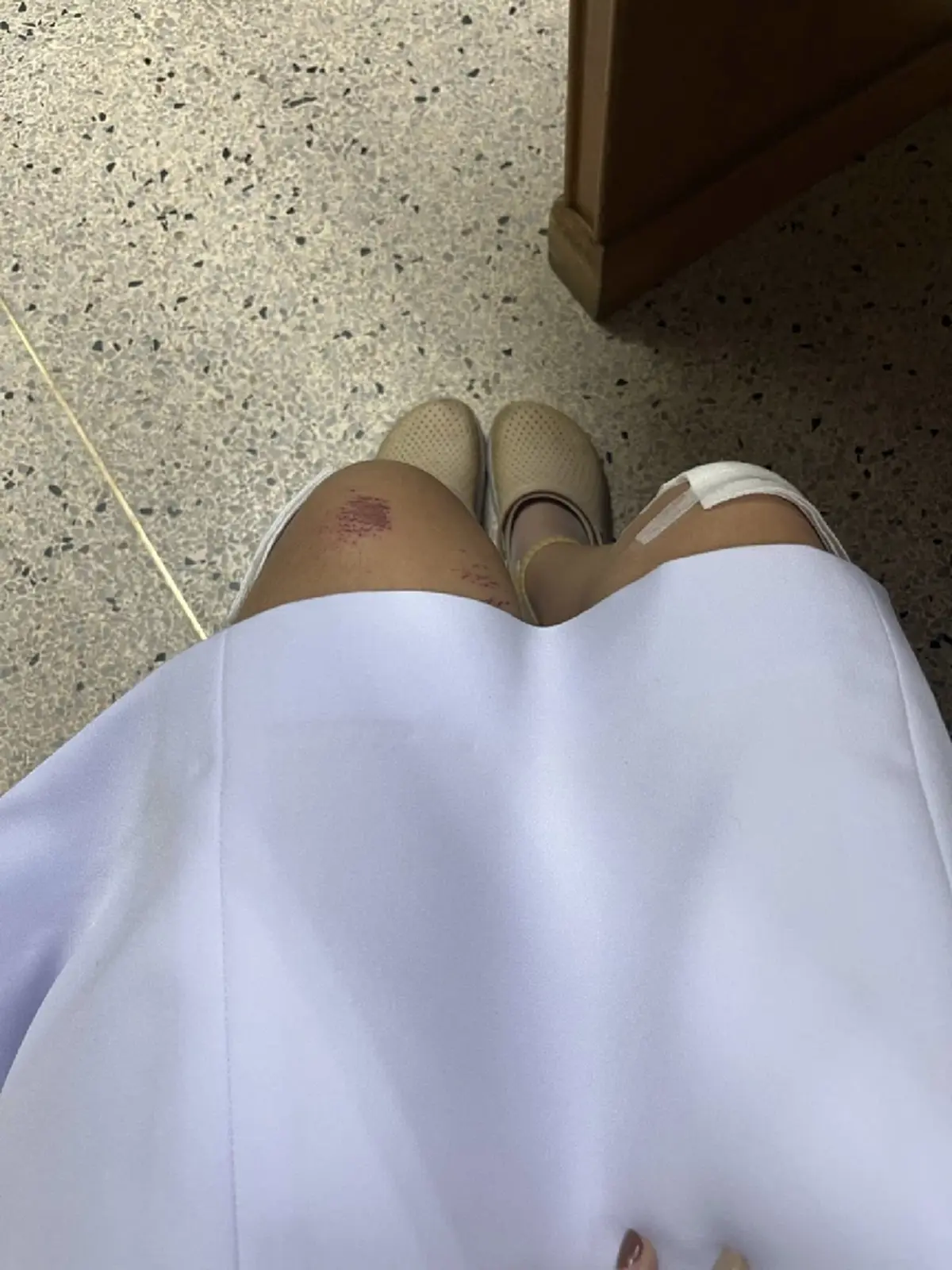 ชีวิตจริงพยาบาลสาว รถล้มเจ็บก็ต้องมาทำงาน เหตุผลตัดสินใจลาออก