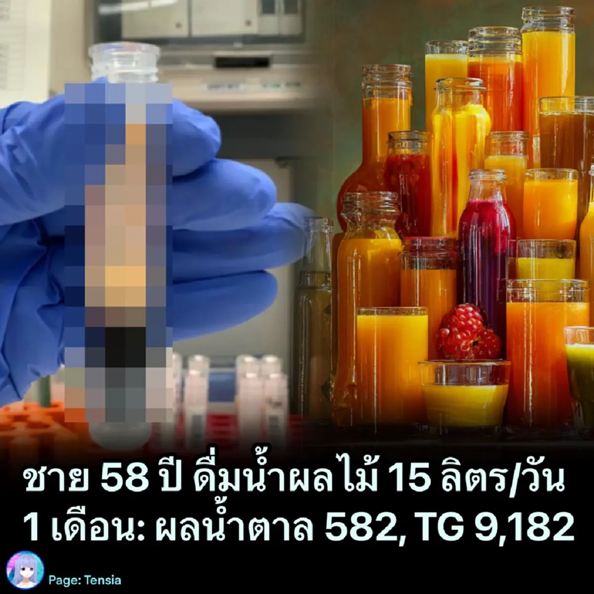 ห๊ะ ชาย58 ดื่มน้ำผลไม้ 15 ลิตร/วัน สุดท้ายผลที่ได้ ผิดคาดไปเยอะ