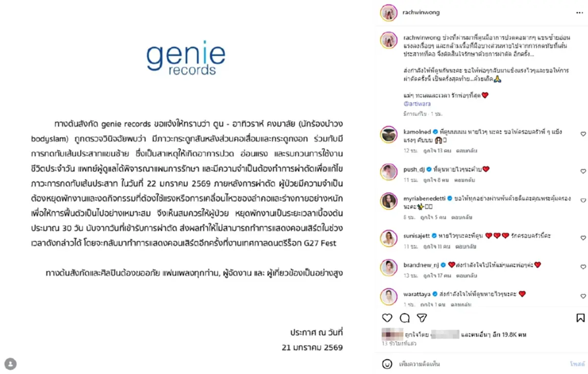 ก้อย รัชวิน เผยอาการ ตูน บอดี้สแลม ผ่าตัดวันนี้ ขอให้เป็นครั้งสุดท้าย