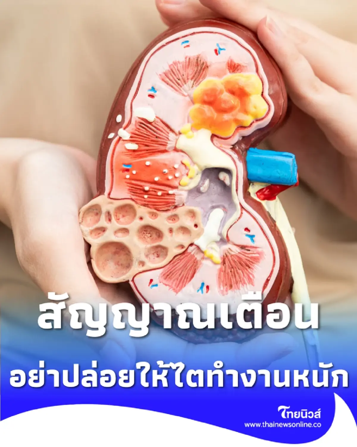 เปิด 5 ลิสต์ต้องห้าม ถ้าอยากรักษาไตให้อยู่กับเราไปนานๆ