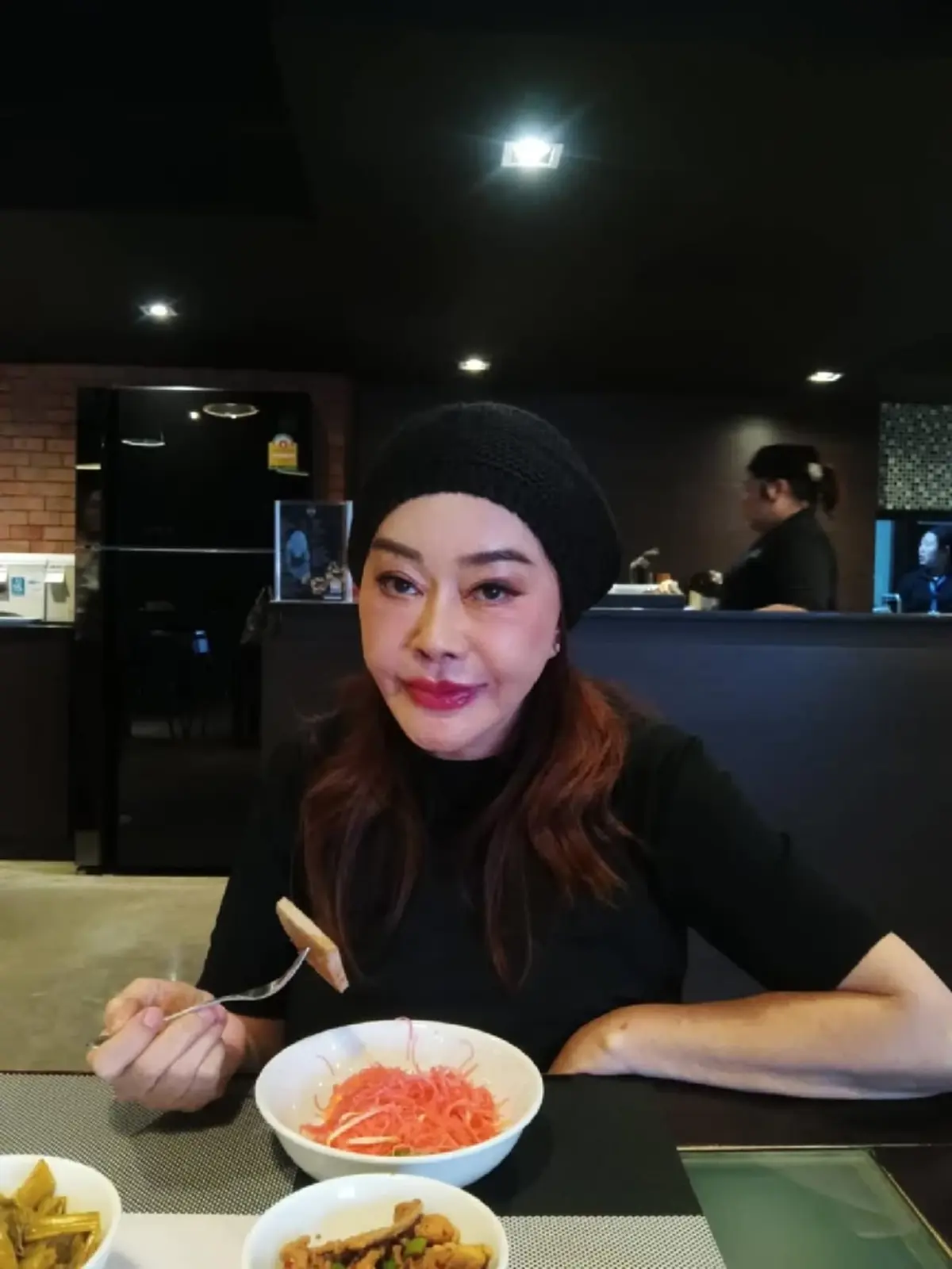 “จิ๊ก เนาวรัตน์” เผยโฉมหน้าใหม่  หลังทนพิษศัลยกรรมนาน 3 ปี