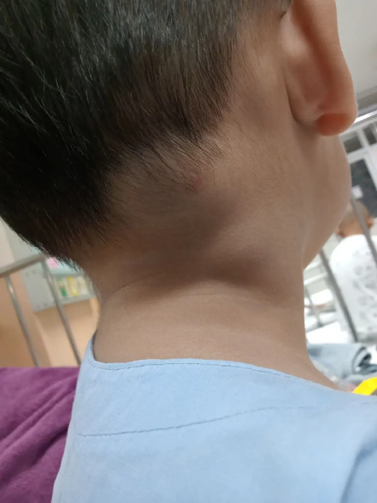 แม่เตือนภัย อย่ามองข้าม ก้อนเล็กๆ จุดเริ่มต้นมะเร็งลูกชาย