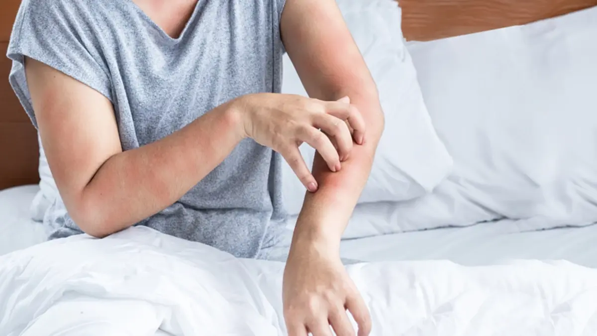  เช็กด่วน 4 อาการเตือน ร่างกายกำลังแพ้ฝุ่น PM2.5 อย่าปล่อยไว้นาน