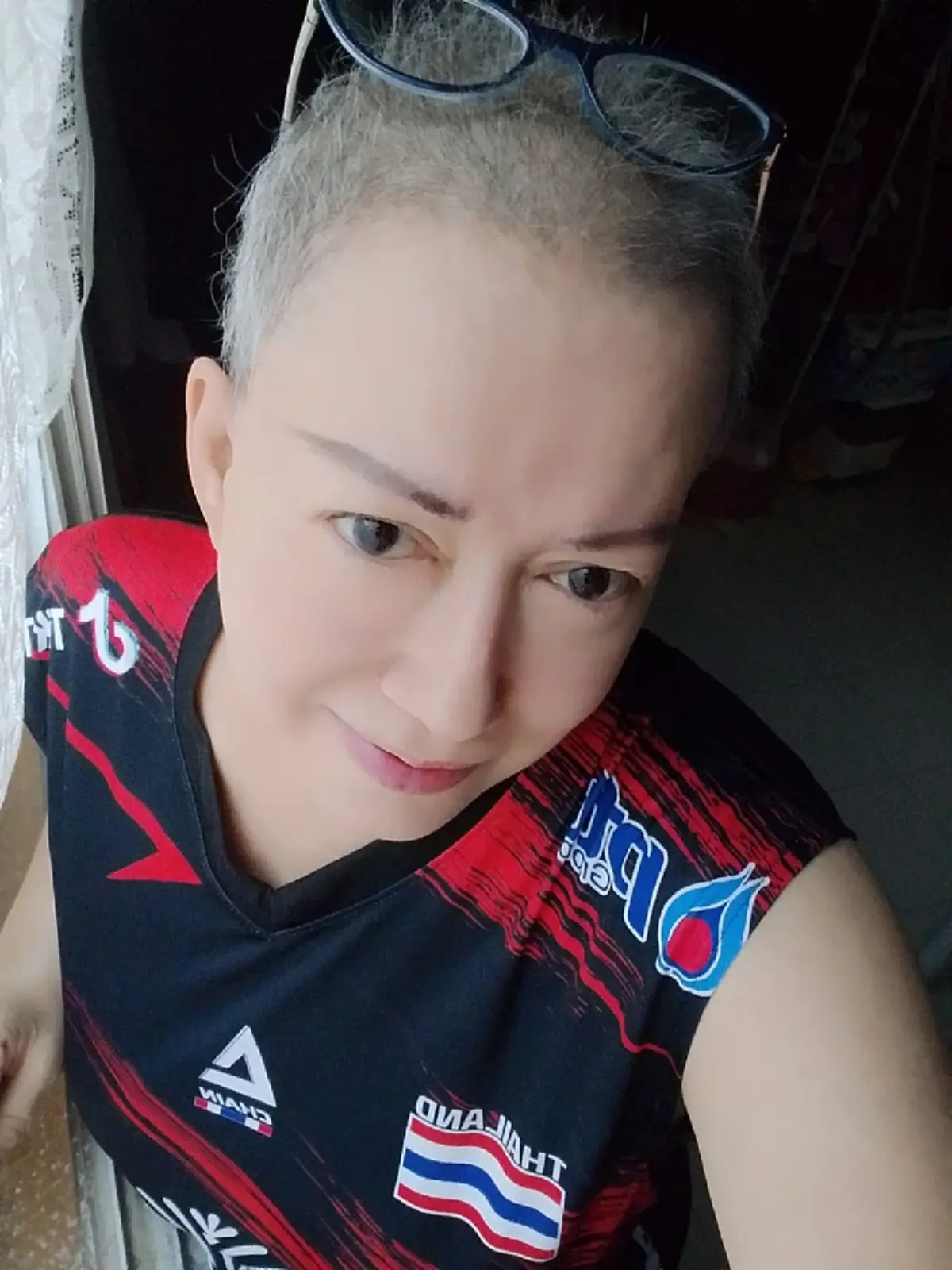 ยิ้มสู้ อดีตนักแสดงดัง หมอเพิ่มคีโม ต้องโกนผมอีกรอบ