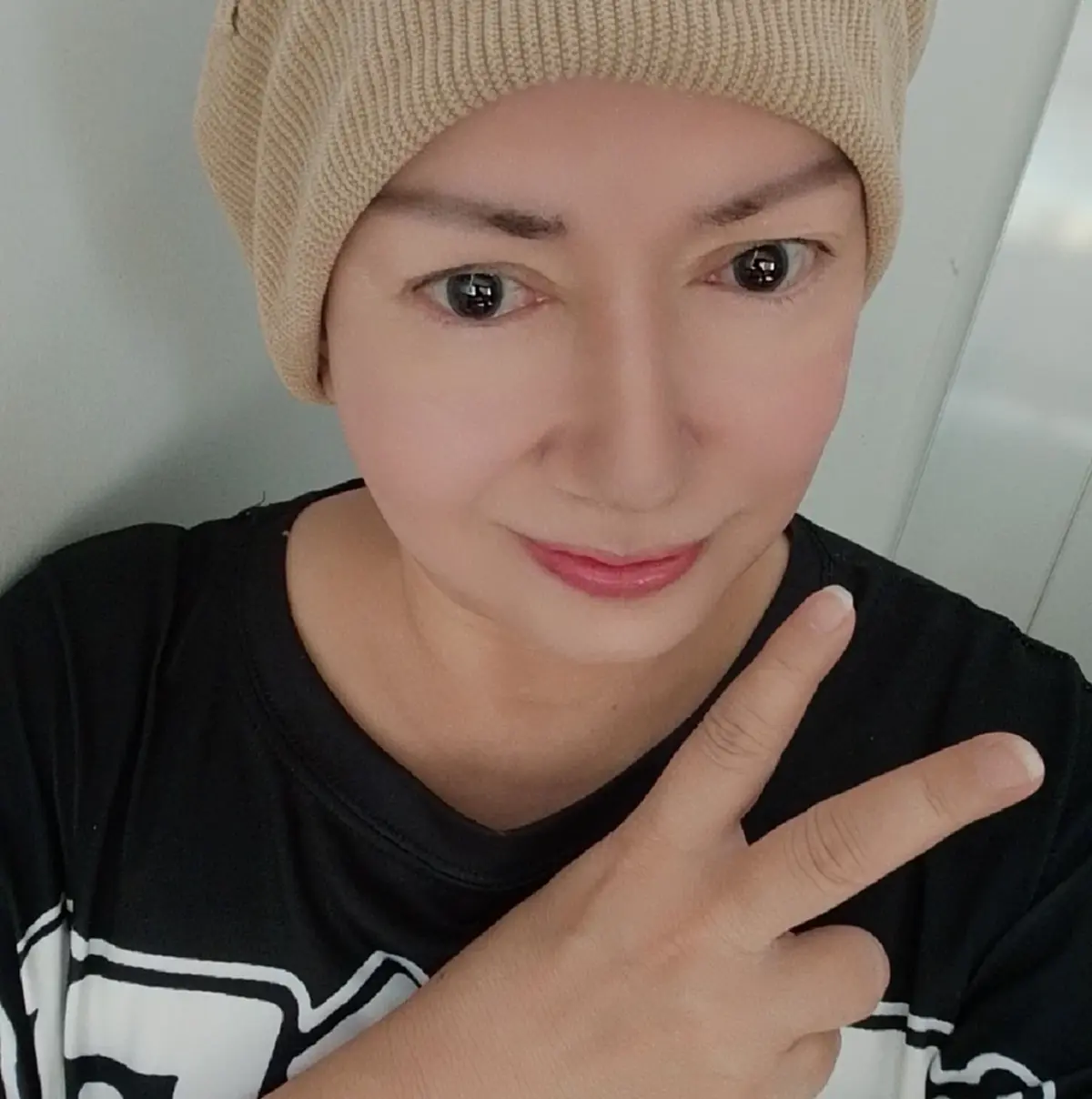 ยิ้มสู้ อดีตนักแสดงดัง หมอเพิ่มคีโม ต้องโกนผมอีกรอบ