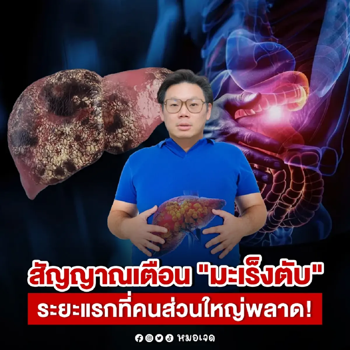 5 สัญญาณเงียบ "มะเร็งตับระยะแรก" หลายคนมารู้อีกที ก็สายไปแล้ว