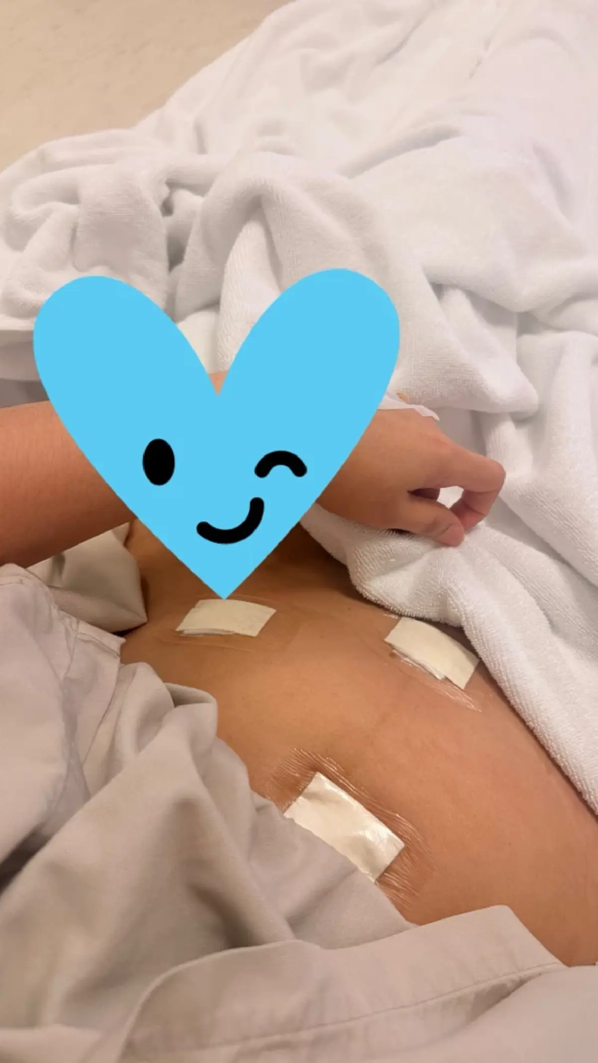 สาวนึกว่าตัวเองอ้วน เจอเนื้องอกมดลูก เตือนอาการที่ห้ามชะล่าใจ