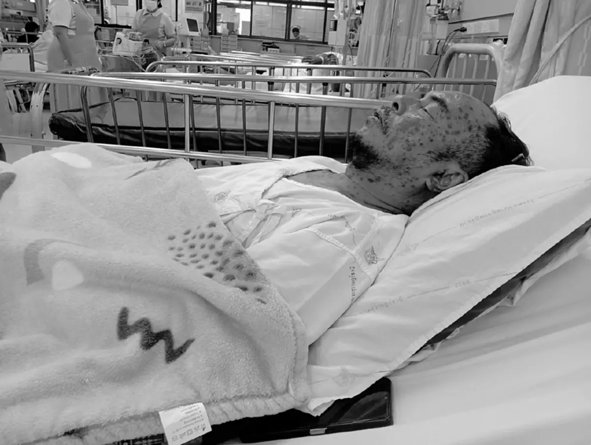 "นิค อสรพิษวิทยา" วอนน้ำใจช่วย "พี่ดม" จิตอาสาจับงูป่วยหนัก