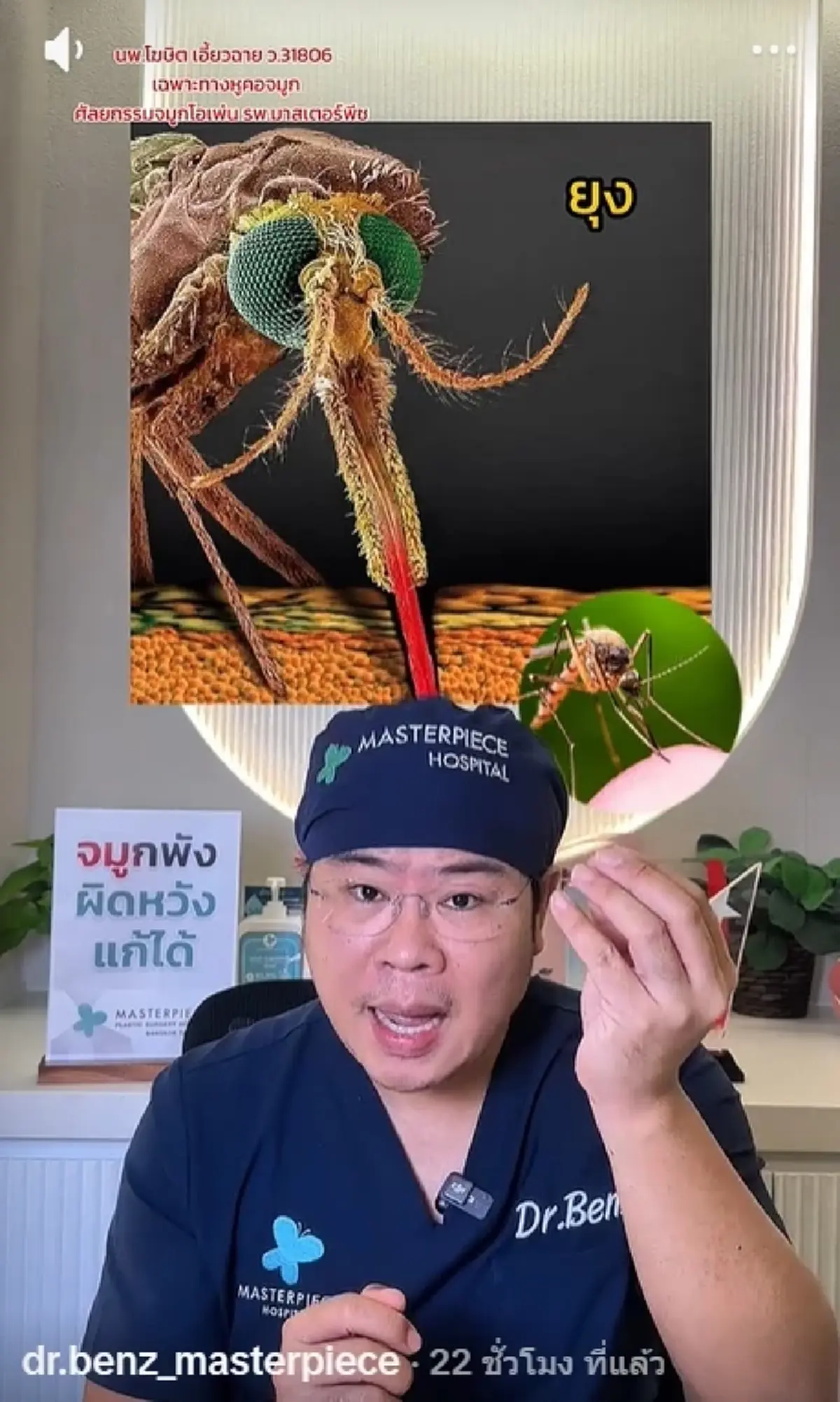 หมอดัง เผยชัด "ยุง vs คุ่น" ต่างกันตรงไหน เสี่ยงติดเชื้อได้ยังไง