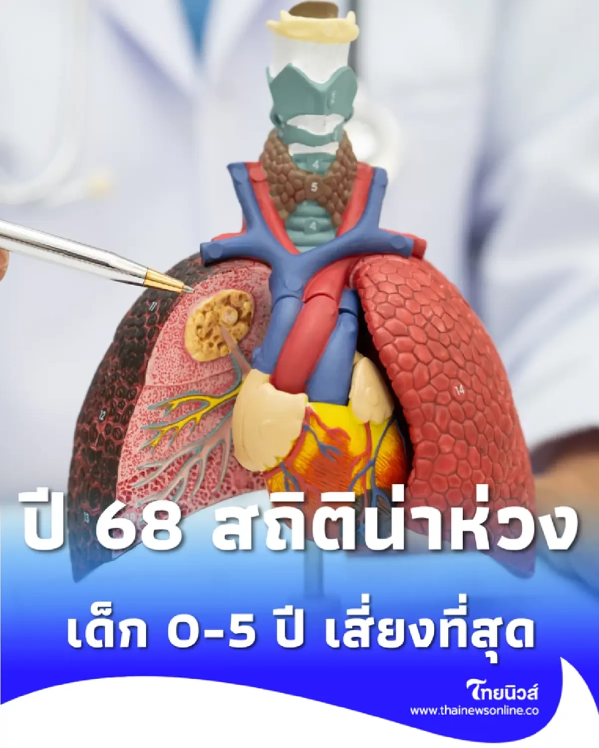 ส่องสถานการณ์โรคปอดอักเสบเด็กไทยปี 2568 สถิติพุ่งสูง พ่อแม่ต้องเฝ้าระวังใกล้ชิด