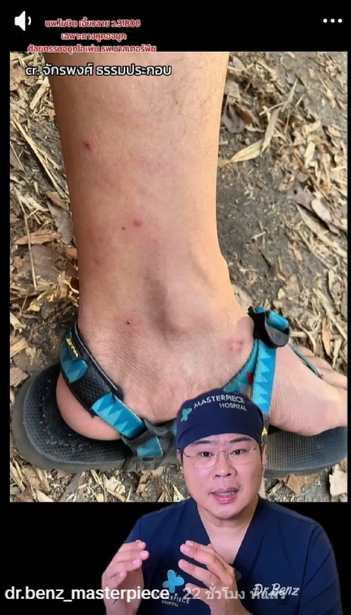 หมอดัง เผยชัด "ยุง vs คุ่น" ต่างกันตรงไหน เสี่ยงติดเชื้อได้ยังไง