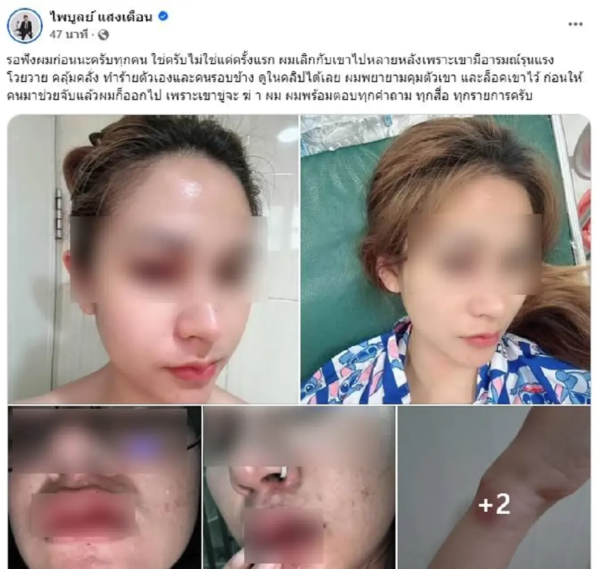 เจอตัวแล้ว นักร้องดัง ฉายา "ลูกชิ้นมีหู" โดนแฉ ทำร้ายร่างกายแฟน