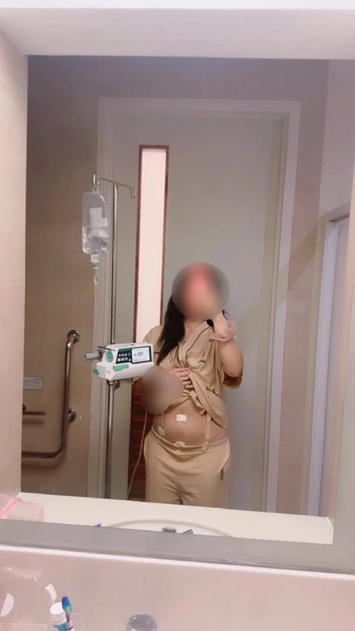 สาวนึกว่าตัวเองอ้วน เจอเนื้องอกมดลูก เตือนอาการที่ห้ามชะล่าใจ