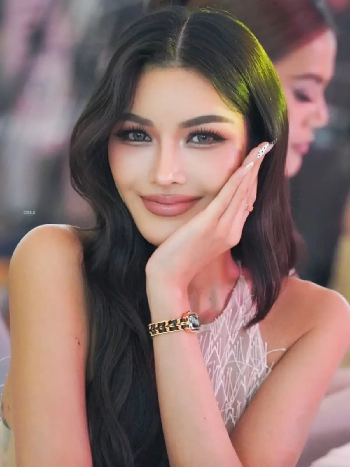 นางงามดัง เล่านาทีซีสต์แตก ต้องผ่าตัดด่วน หมอยังอึ้งถามอดทนได้ไง