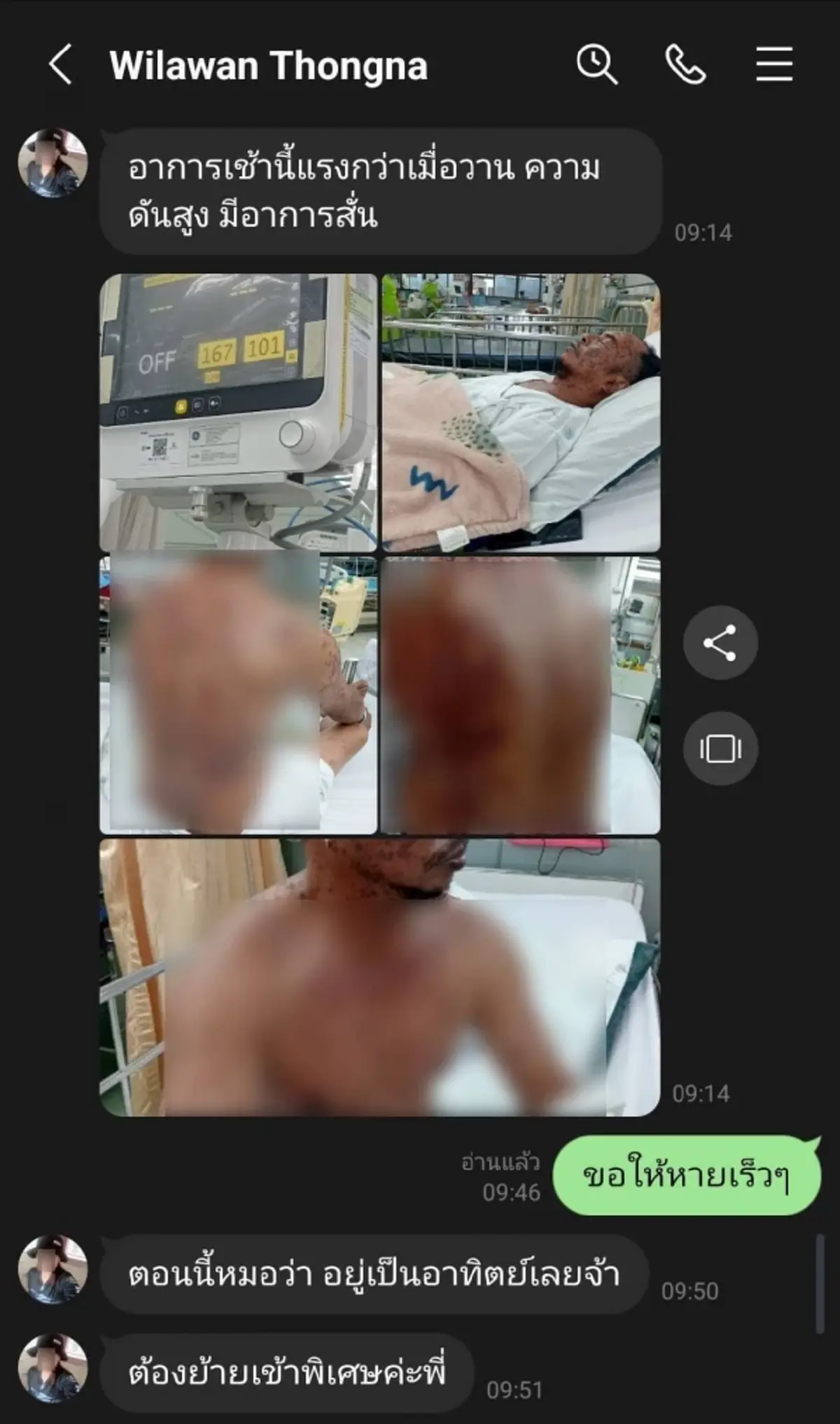 "นิค อสรพิษวิทยา" วอนน้ำใจช่วย "พี่ดม" จิตอาสาจับงูป่วยหนัก