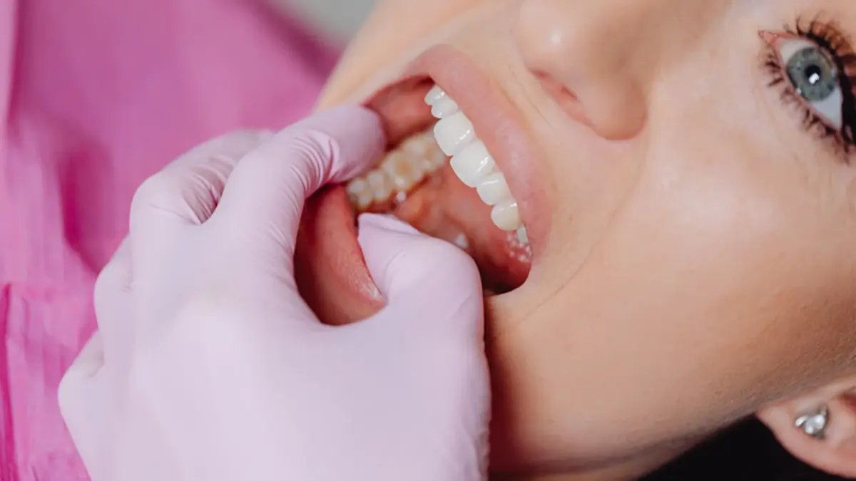 ประกันสังคมไฟเขียว! เพิ่มสิทธิผ่าฟันคุด ไม่ต้องสำรองจ่าย